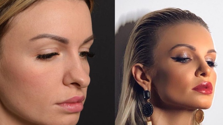 Красотки, которые водят нас за нос: сравниваем фотографии 10 тюменок до и после ринопластики