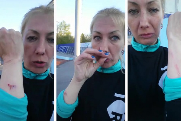 Спортсменка утверждает, что после перепалки на стадионе у неё остались раны на обеих руках Спортсменка утверждает, что после перепалки на стадионе у неё остались раны на обеих руках