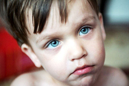 Голубоглазый мальчик из Шарыпова живет с сильным сколиозом и серьезным генетическим заболеванием