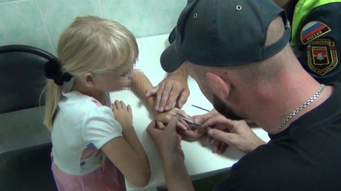 Спасатели сняли с пальца 7-летней девочки металлическую гайку (фото)