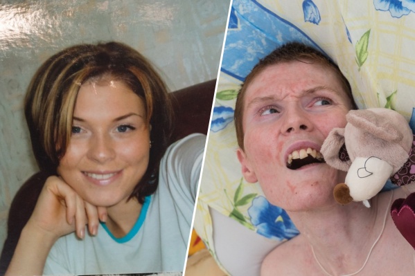 Ирина сильно изменилась за десять лет из-за повреждений мозга, полученных на пожаре Ирина сильно изменилась за десять лет из-за повреждений мозга, полученных на пожаре