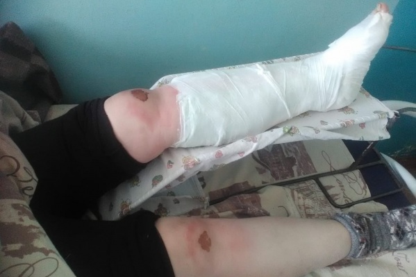 Из-за разрушенной дороги жительница села Радищево серьёзно пострадала Из-за разрушенной дороги жительница села Радищево серьёзно пострадала