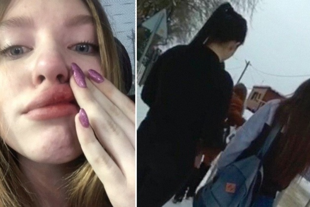 На блогершу напали несколько девочек после занятий в школе в конце февраля На блогершу напали несколько девочек после занятий в школе в конце февраля