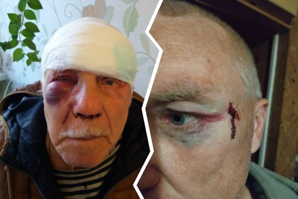 Сын Бориса Георгиевича Николай уверяет, что не бил своего отца. Но сам едва не остался без глаза от кулаков пожилого мужчины Сын Бориса Георгиевича Николай уверяет, что не бил своего отца. Но сам едва не остался без глаза от кулаков пожилого мужчины