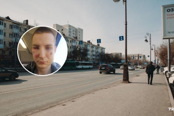 На Тимофея Требухова напали в центре города — на Республики, 81. В результате избиения он получил травмы лица и головы, в том числе перелом носа На Тимофея Требухова напали в центре города — на Республики, 81. В результате избиения он получил травмы лица и головы, в том числе перелом носа