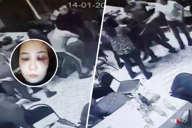Потасовка в кафе произошла под утро 14 января. На снимке Лиана Шамсиева, которая получила травмы во время драки. Девушка сняла побои и обратилась в полицию