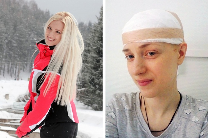 Кристина Приходько перенесла две операции на головном мозге, но теперь её здоровье в порядке Кристина Приходько перенесла две операции на головном мозге, но теперь её здоровье в порядке
