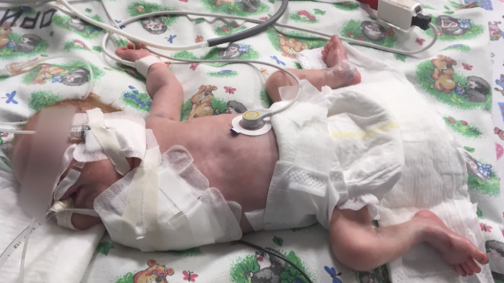 Новорожденного, которому ампутировали руку в перинатальном центре Уфы, выписали домой