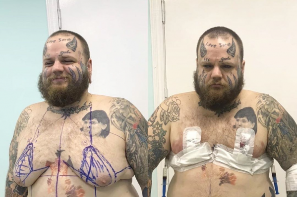 Несмотря на эпатажный внешний вид, блогер стеснялся своего тела Несмотря на эпатажный внешний вид, блогер стеснялся своего тела