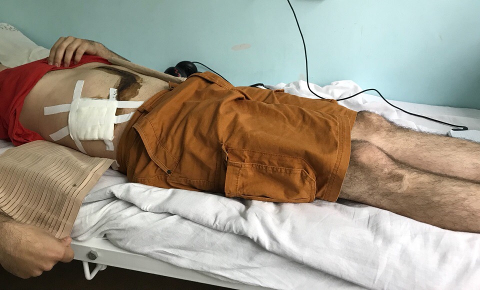 Небольшие опухоли хирурги Центра удаляют без разрезов — малоинвазивным методом. А поскольку эта опухоль была такой большой, врачи применили лапаротомию Небольшие опухоли хирурги Центра удаляют без разрезов — малоинвазивным методом. А поскольку эта опухоль была такой большой, врачи применили лапаротомию
