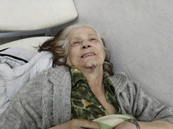 На вид Екатерине Федоровне 70–75 лет На вид Екатерине Федоровне 70–75 лет
