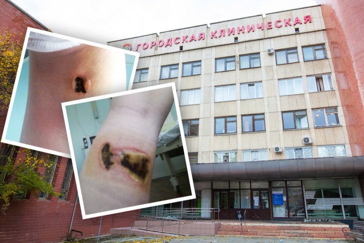 Горбольницу № 1 проверяют следователи, прокуратура и ФОМС из-за полученных школьницей ожогов Горбольницу № 1 проверяют следователи, прокуратура и ФОМС из-за полученных школьницей ожогов