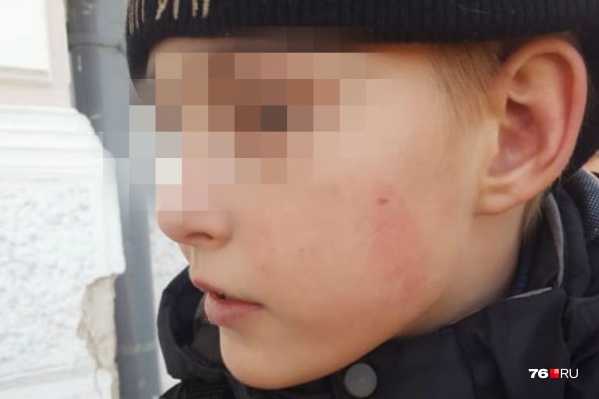 Мальчик попал под руку разбушевавшегося рабочего Мальчик попал под руку разбушевавшегося рабочего