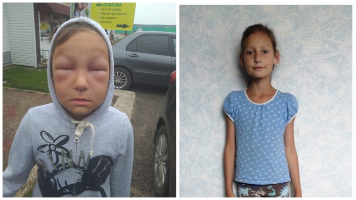 В Башкирии восьмилетнего ребенка до полусмерти покусали соседские пчелы