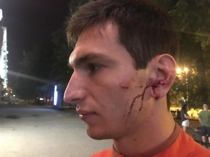 По словам Николая Коляды, Мурада Халимбекова ударили кирпичом по голове По словам Николая Коляды, Мурада Халимбекова ударили кирпичом по голове