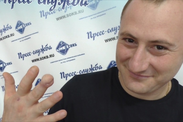 Счастливый мужчина с восстановленной фалангой Счастливый мужчина с восстановленной фалангой