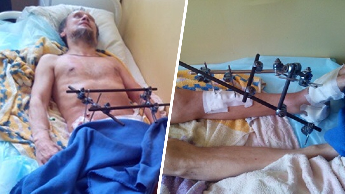 «В пути ему стало плохо»: в Перми на суд повезли лежачего больного с переломами голени, груди и таза