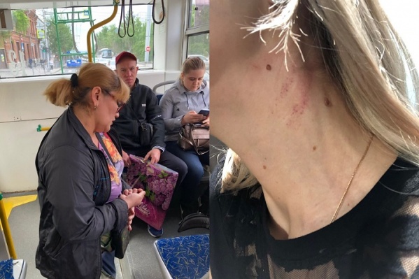 Пострадавшая девушка сфотографировала троллейбус, в котором произошёл конфликт Пострадавшая девушка сфотографировала троллейбус, в котором произошёл конфликт