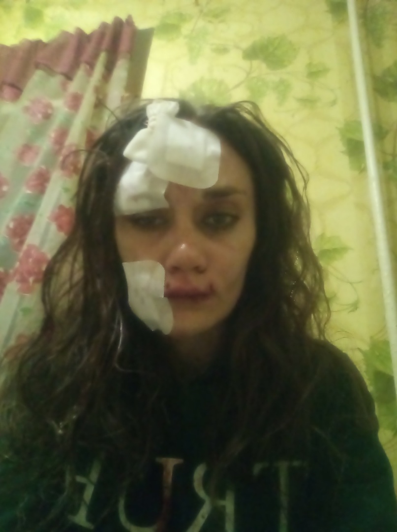 Ирина после больницы Ирина после больницы