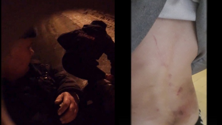 «Встань и веди себя подобающим образом!»: в Рыбинске полицейские избили подростка