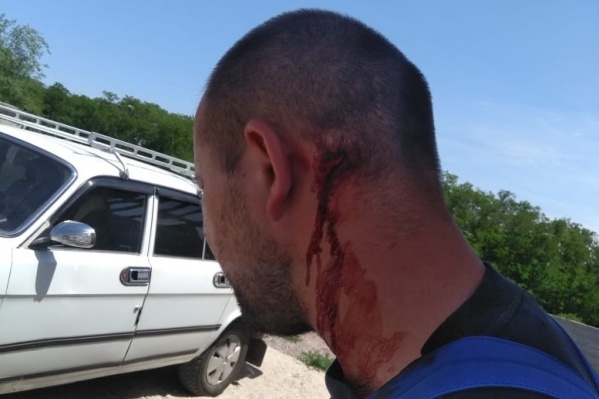 Юлия утверждает, что Черненко нанес ее мужу удар по голове ломом Юлия утверждает, что Черненко нанес ее мужу удар по голове ломом