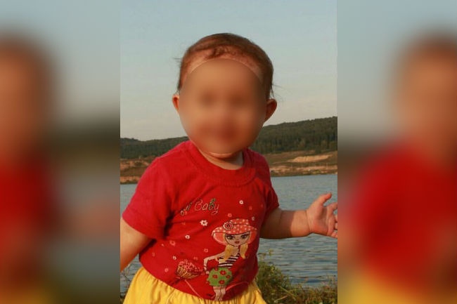 Полине нужна пересадка кожи Полине нужна пересадка кожи