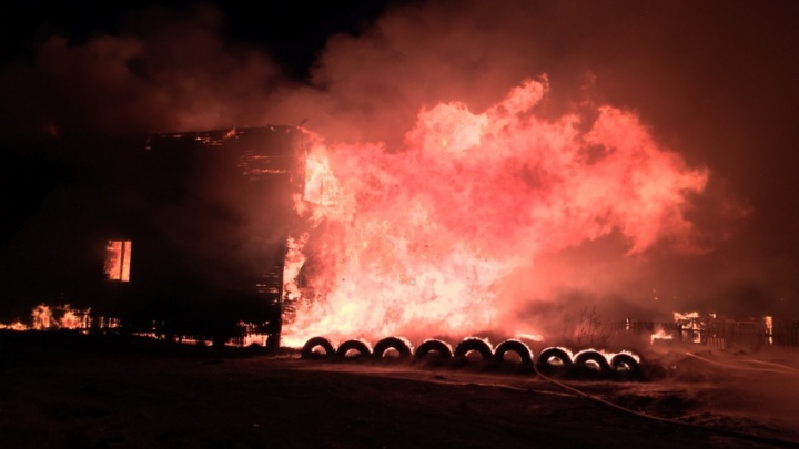 Нижегородские врачи спасают жителя Архангельска, который пытался вытащить тещу из огня