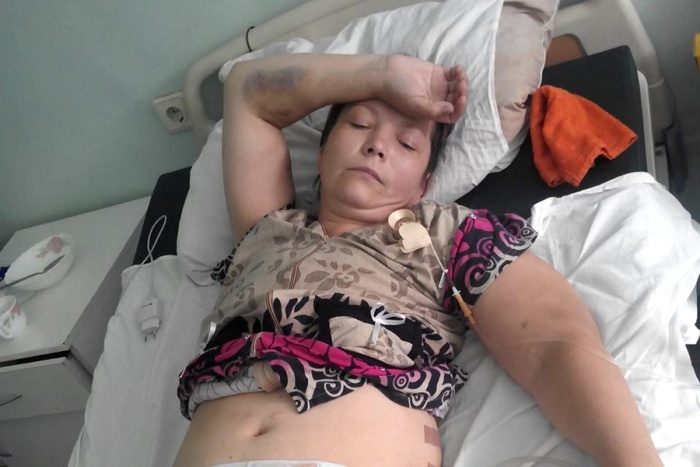 После операции в Краснозёрской районной больнице у Оксаны Бугояк отказали почки