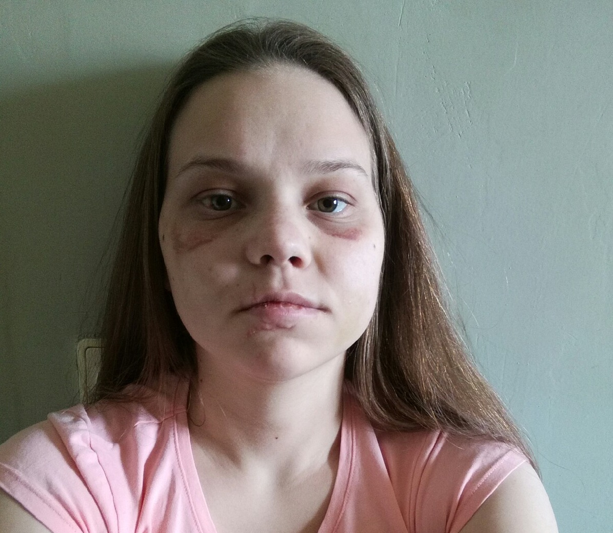 Вред здоровью Ольги Пискотиной оценили как тяжкий Вред здоровью Ольги Пискотиной оценили как тяжкий 