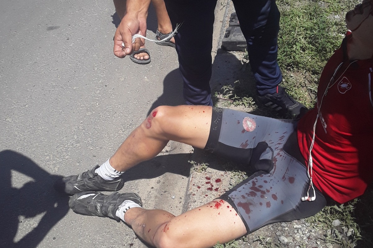 Визуально обошлось ссадинами Визуально обошлось ссадинами