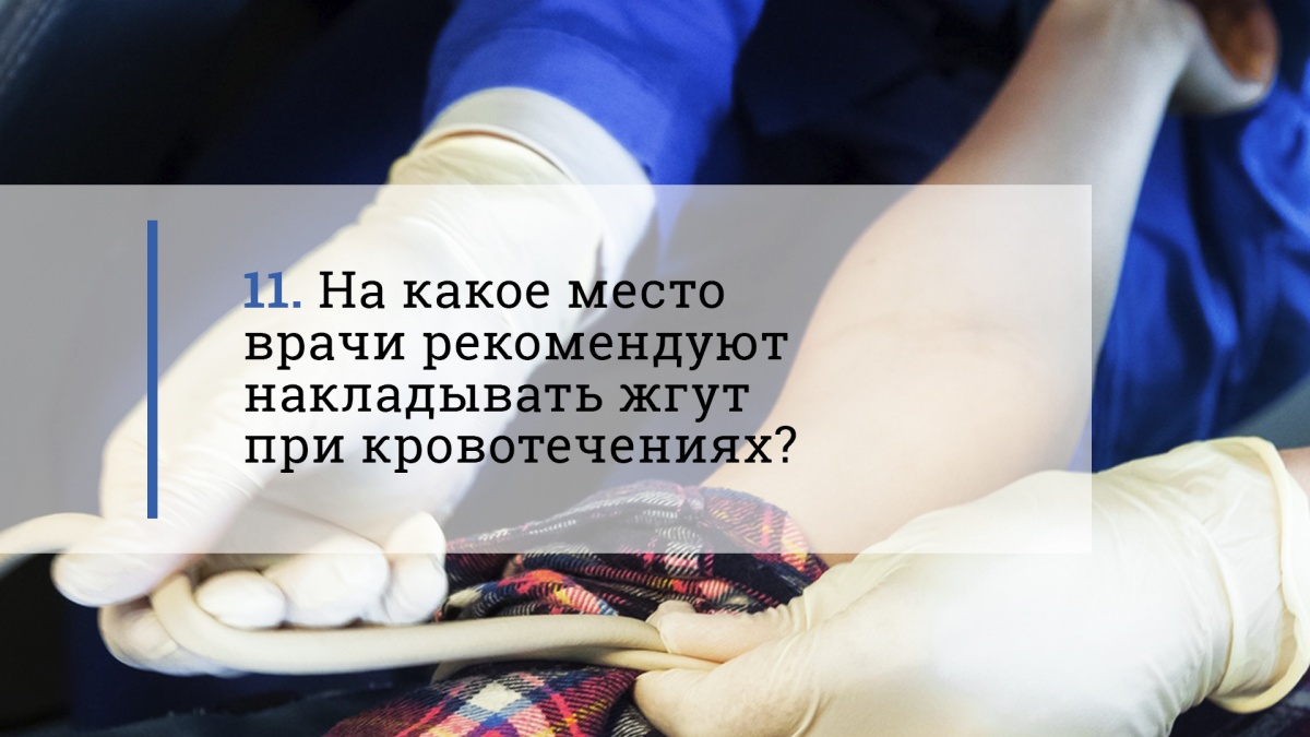 На какое место врачи
рекомендуют накладывать жгут при
кровотечениях?