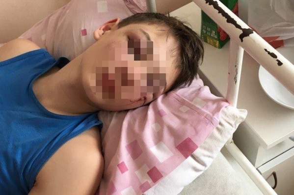 Пострадавший школьник после избиения попал в больницу Пострадавший школьник после избиения попал в больницу