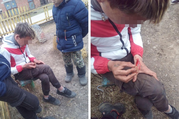 Подросткам не понравилась тату на руке знакомого, поэтому они заставили его соскребать надпись раскаленным гвоздем Подросткам не понравилась тату на руке знакомого, поэтому они заставили его соскребать надпись раскаленным гвоздем