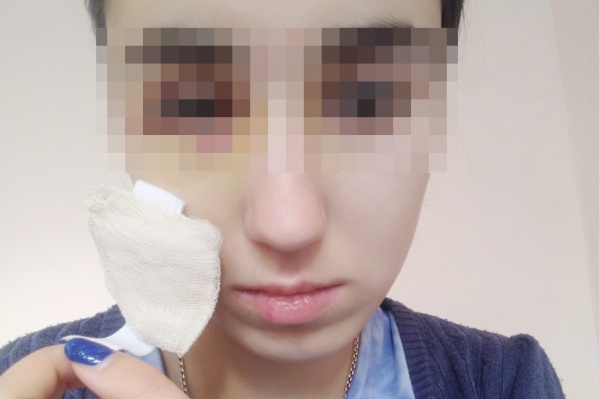 Зрение спасти не удалось Зрение спасти не удалось