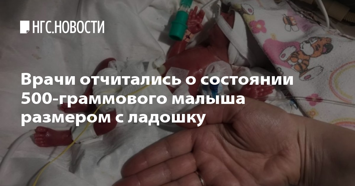 500 граммовый ребенок 20 500 граммовый ребенок 55